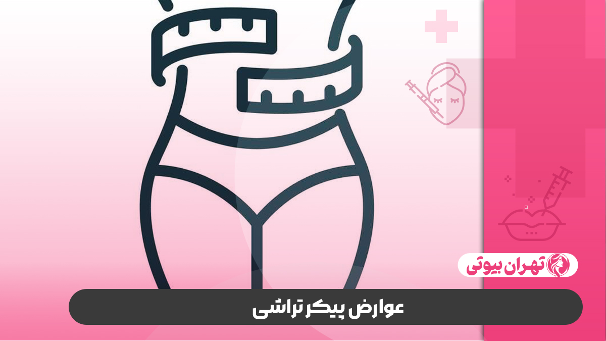 10 بهترین دکتر پیکر تراشی در شیراز
