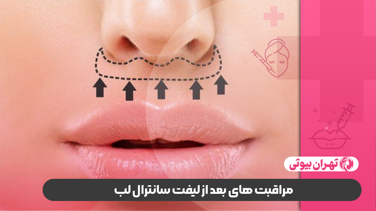10 بهترین دکتر لیفت سانترال لب در شیراز