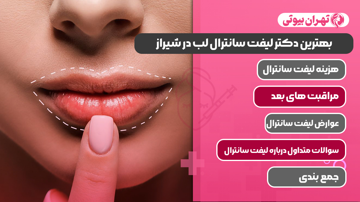 10 بهترین دکتر لیفت سانترال لب در شیراز