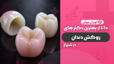 10 بهترین دکتر روکش دندان در شیراز