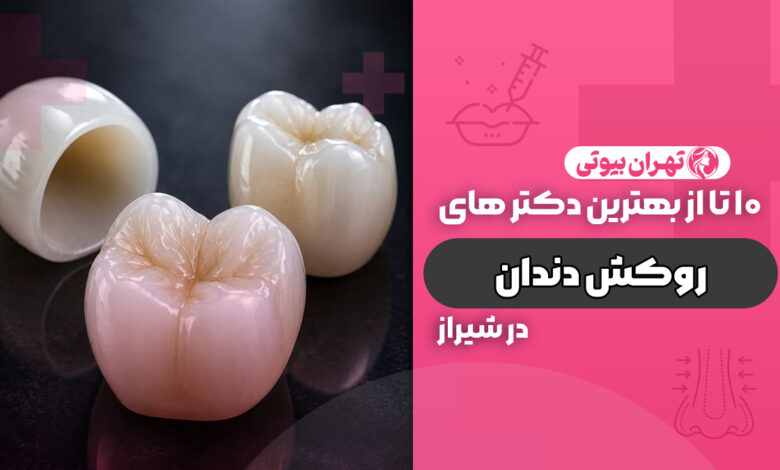 10 بهترین دکتر روکش دندان در شیراز