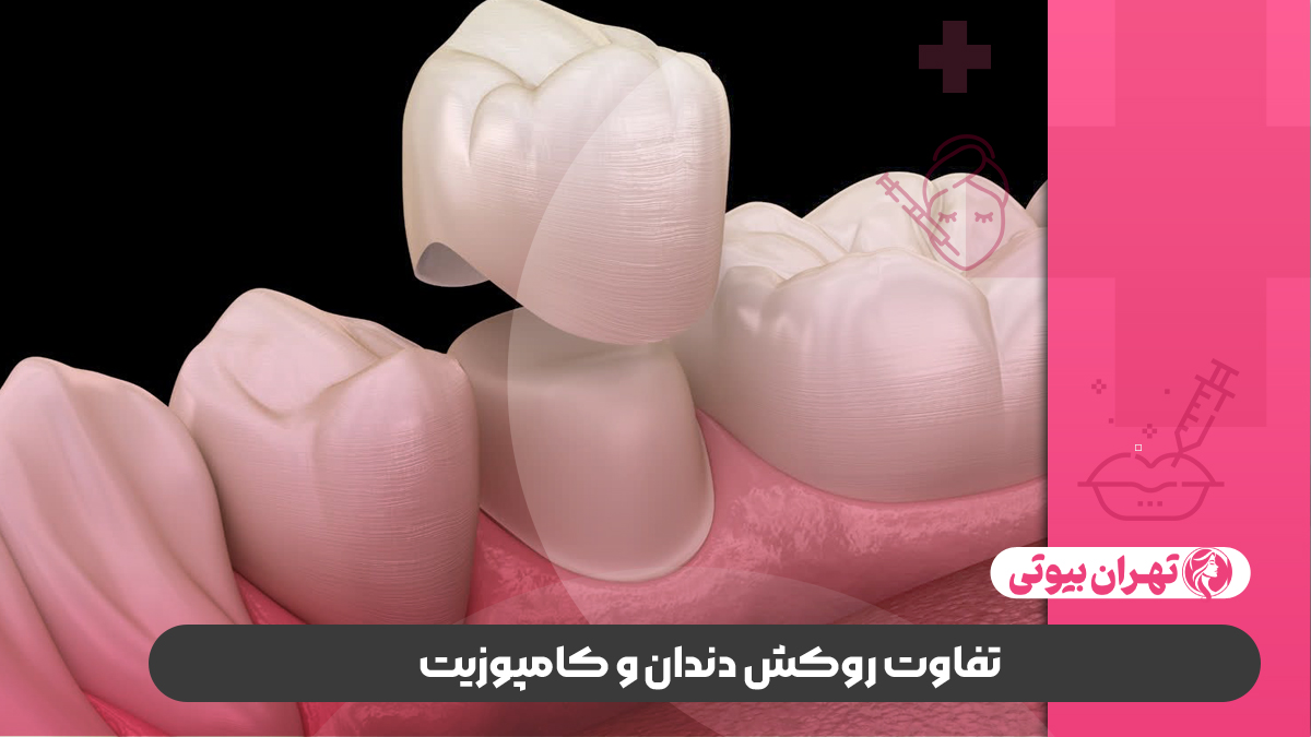 10 بهترین دکتر روکش دندان در شیراز