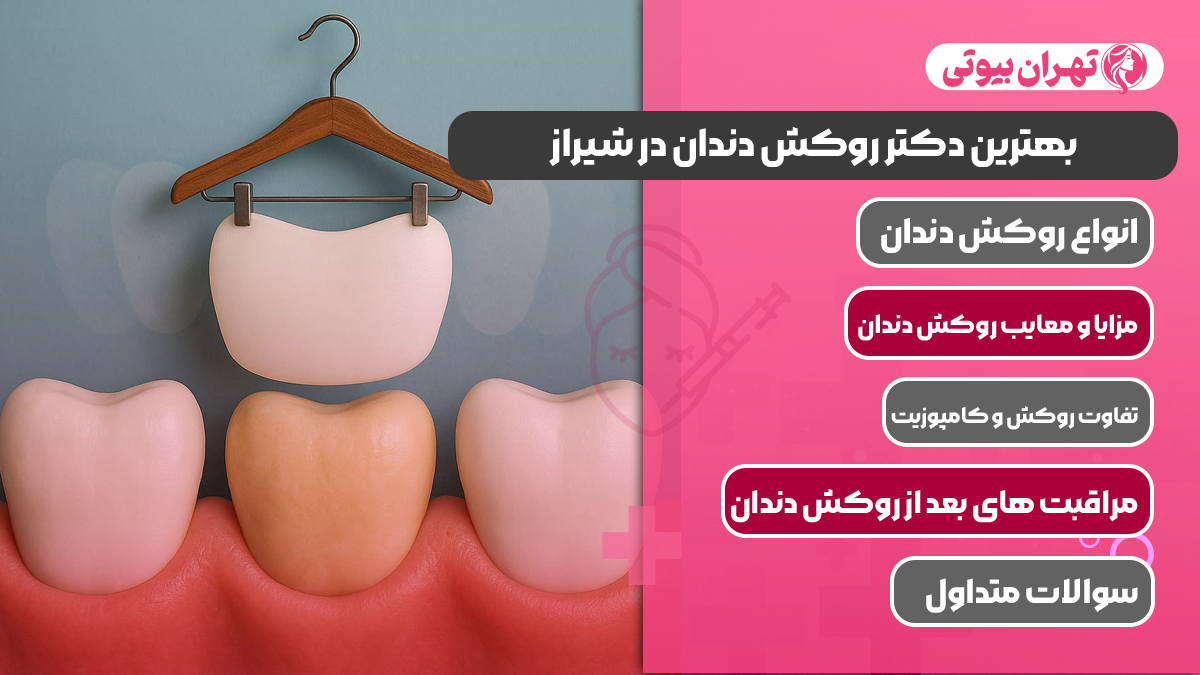 10 بهترین دکتر روکش دندان در شیراز