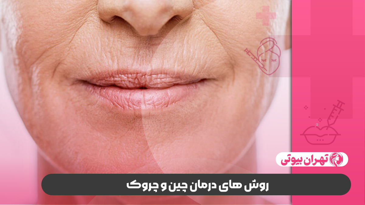 10 بهترین دکتر درمان چین و چروک صورت در شیراز