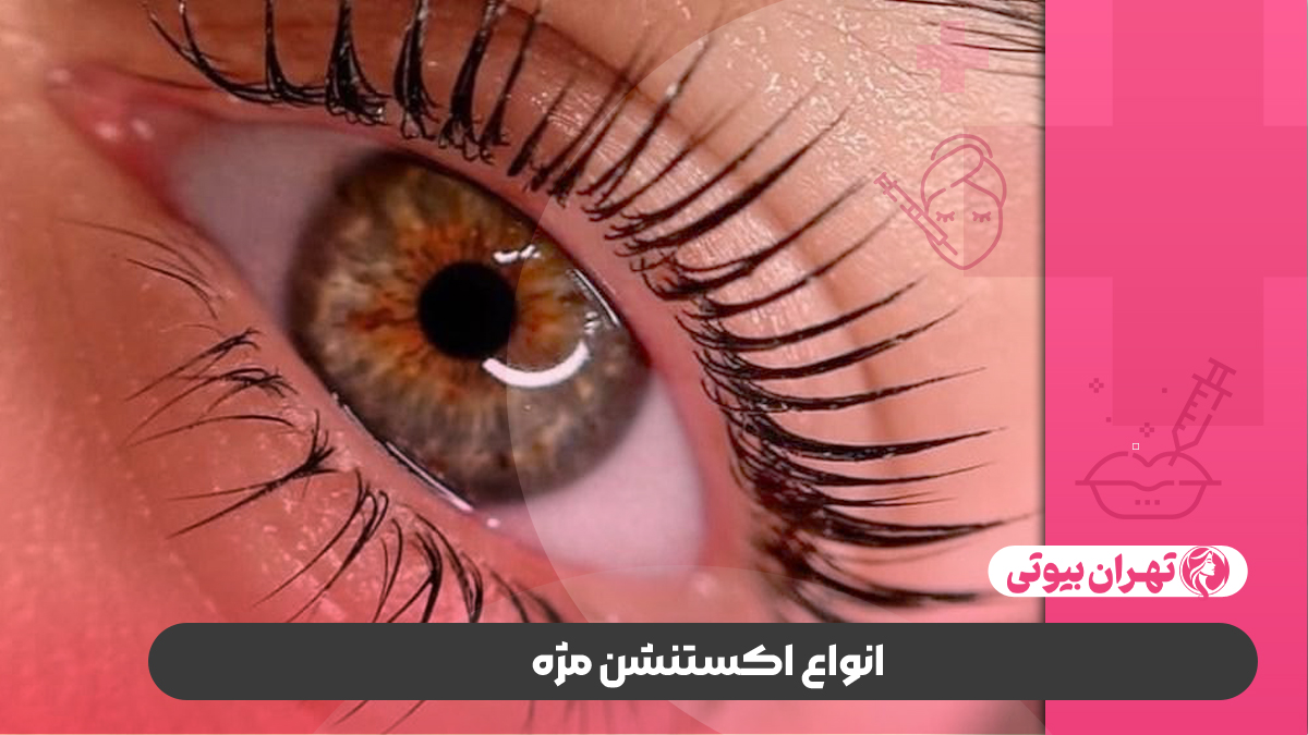 10 بهترین مرکز اکستنشن مژه در صدرا