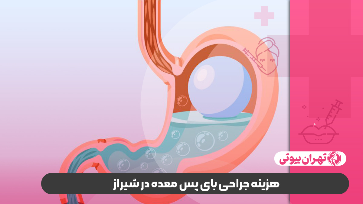 10 بهترین دکتر بای پس معده در شیراز