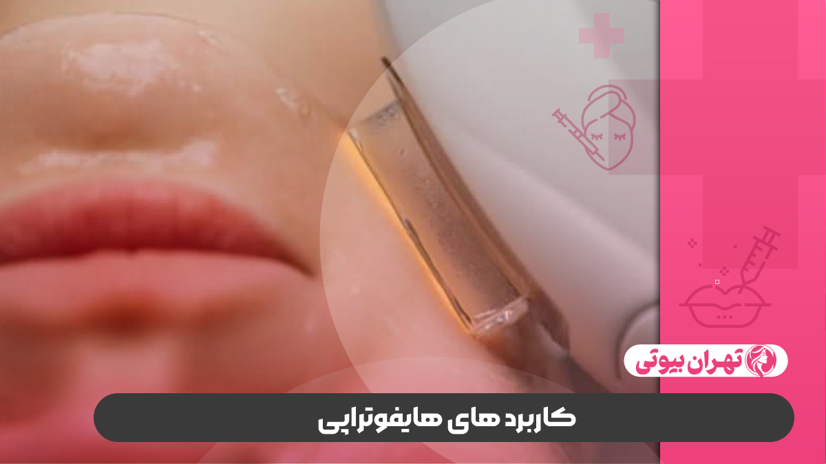 10 بهترین دکتر هایفوتراپی در شیراز