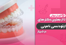 10 بهترین دکتر ارتودنسی نامرئی در شیراز