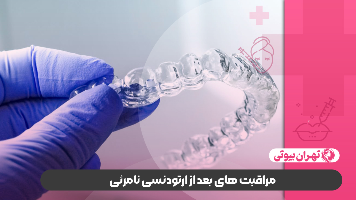 10 بهترین دکتر ارتودنسی نامرئی در شیراز