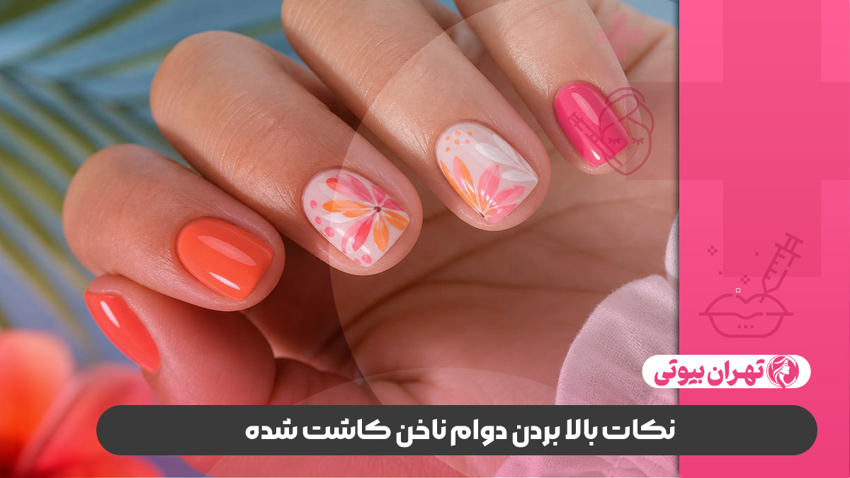 10 بهترین سالن کاشت ناخن در صدرا