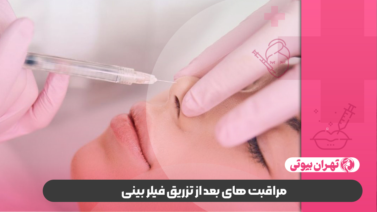10 بهترین دکتر تزریق فیلر بینی در شیراز