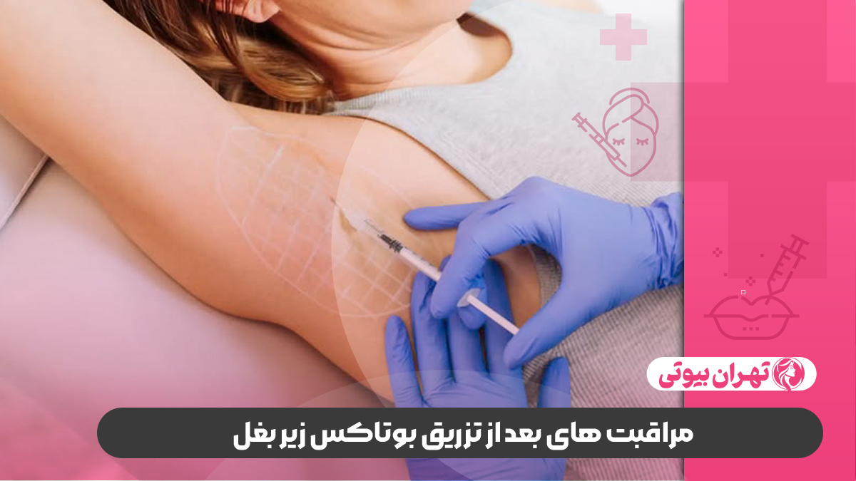 10 بهترین دکتر بوتاکس زیر بغل در شیراز