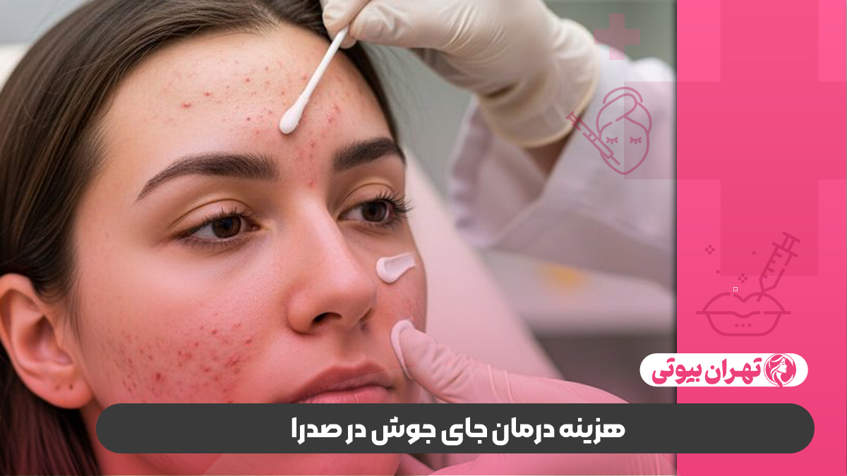 10 بهترین دکتر درمان جای جوش در صدرا