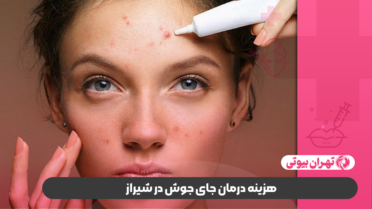 10 بهترین دکتر درمان جای جوش در شیراز