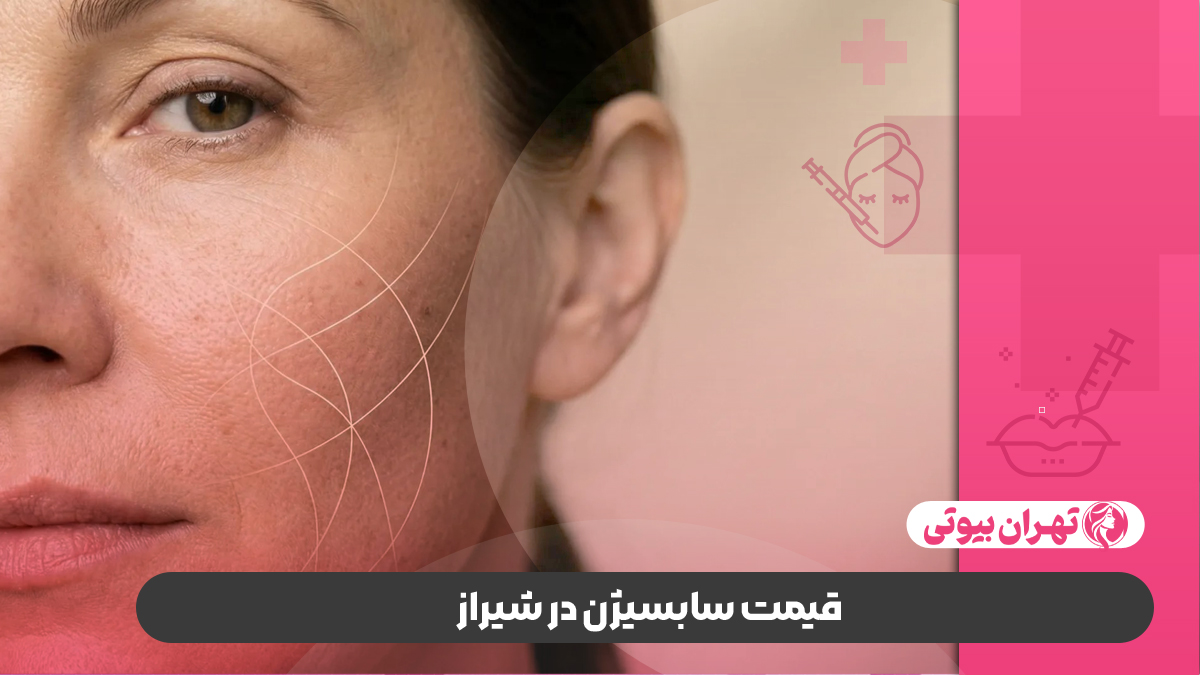 10 بهترین دکتر سابسیژن در شیراز