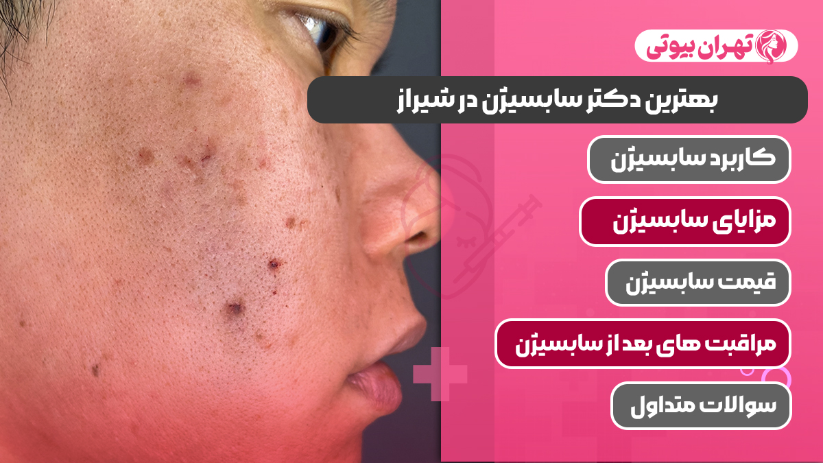 10 بهترین دکتر سابسیژن در شیراز