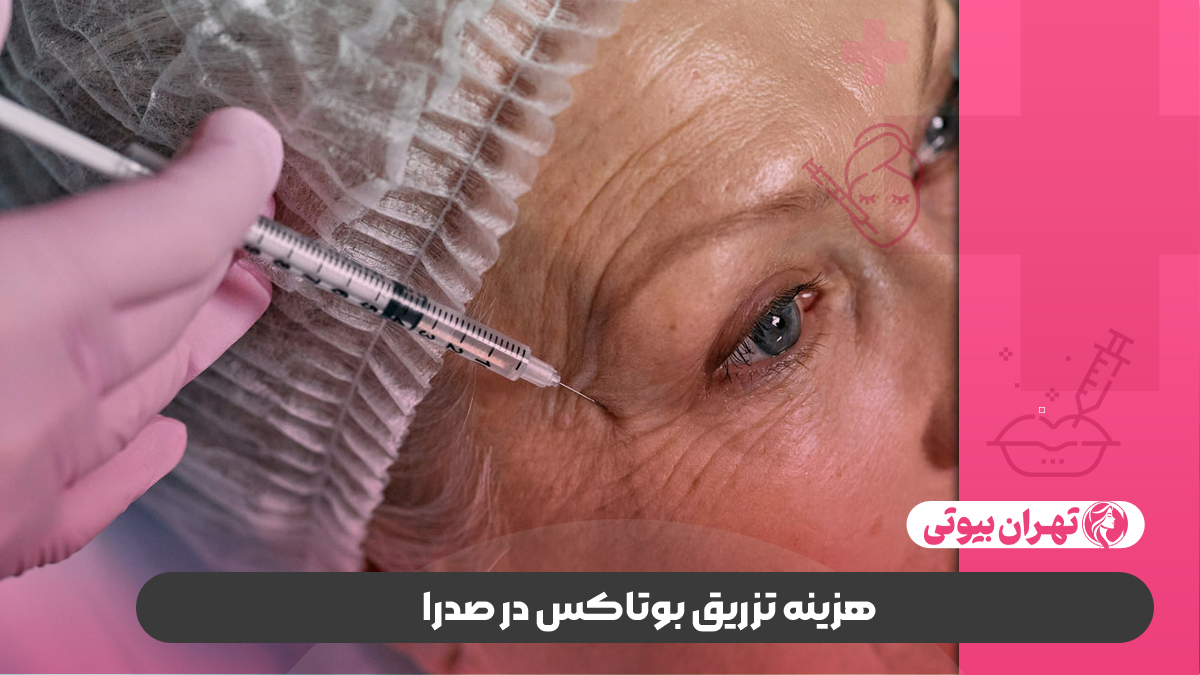 10 بهترین دکتر تزریق بوتاکس در صدرا