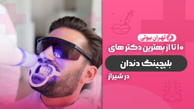 10 بهترین دکتر بلیچینگ دندان در شیراز