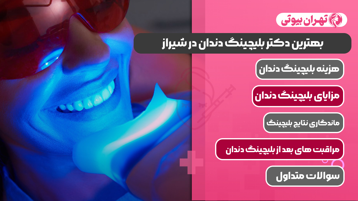 10 بهترین دکتر بلیچینگ دندان در شیراز